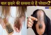बाल झड़ने की समस्या से हैं परेशान? अपनाएं ये 5 आसान घरेलू उपाय, बाल बनेंगे लंबे, काले और घने